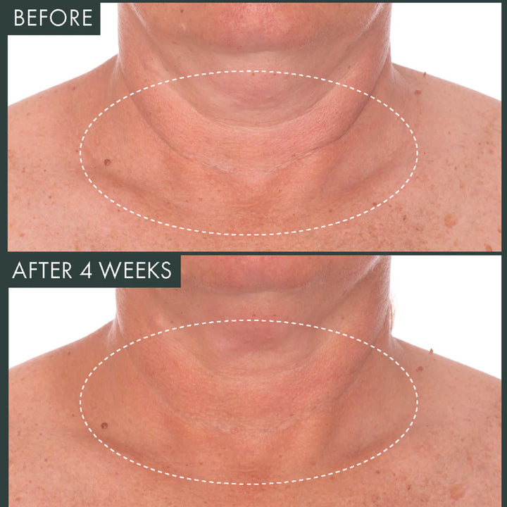 FERMITIF NECK RENEWAL NIGHT CREAM