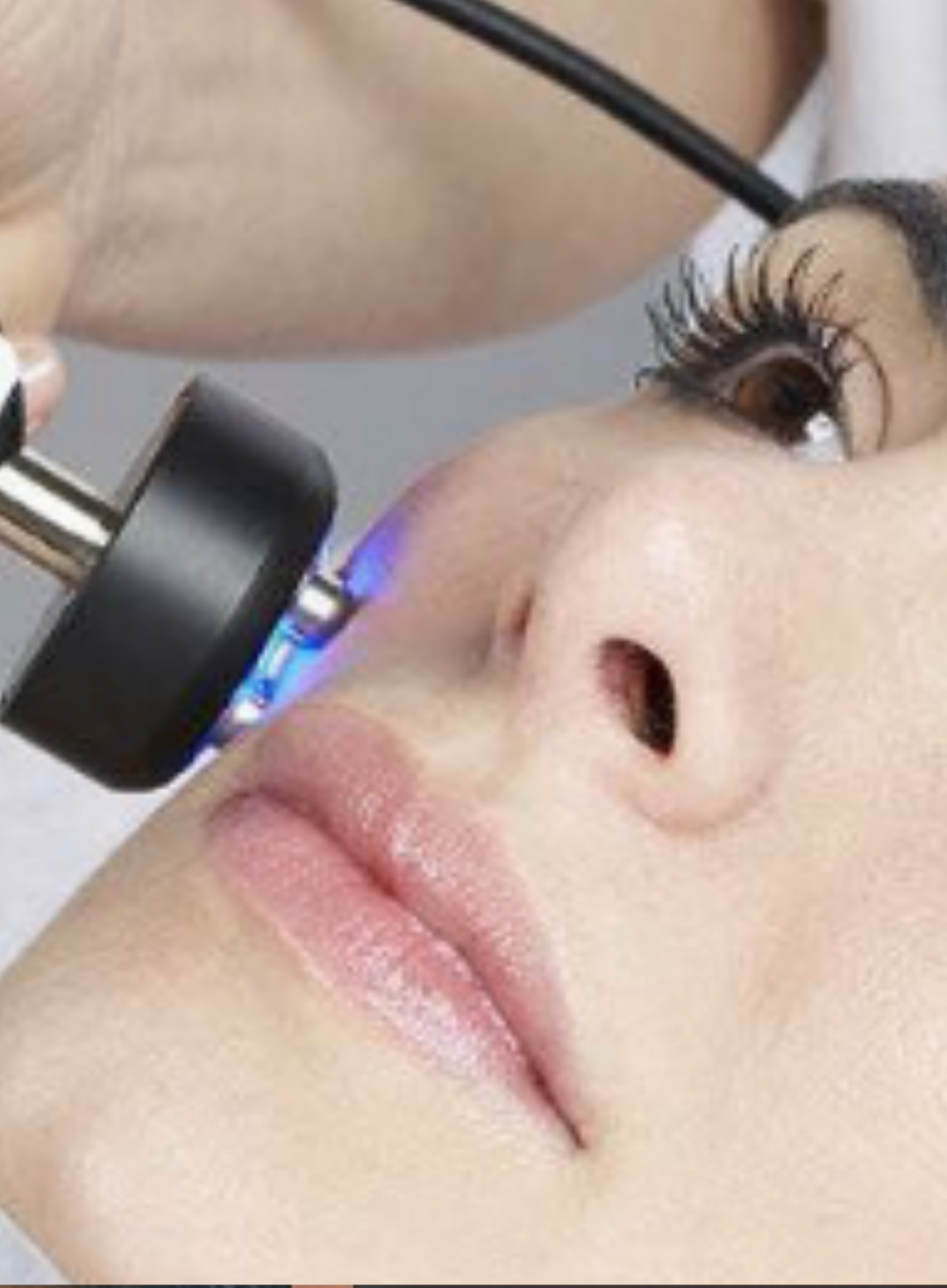 RF-Lift Overline