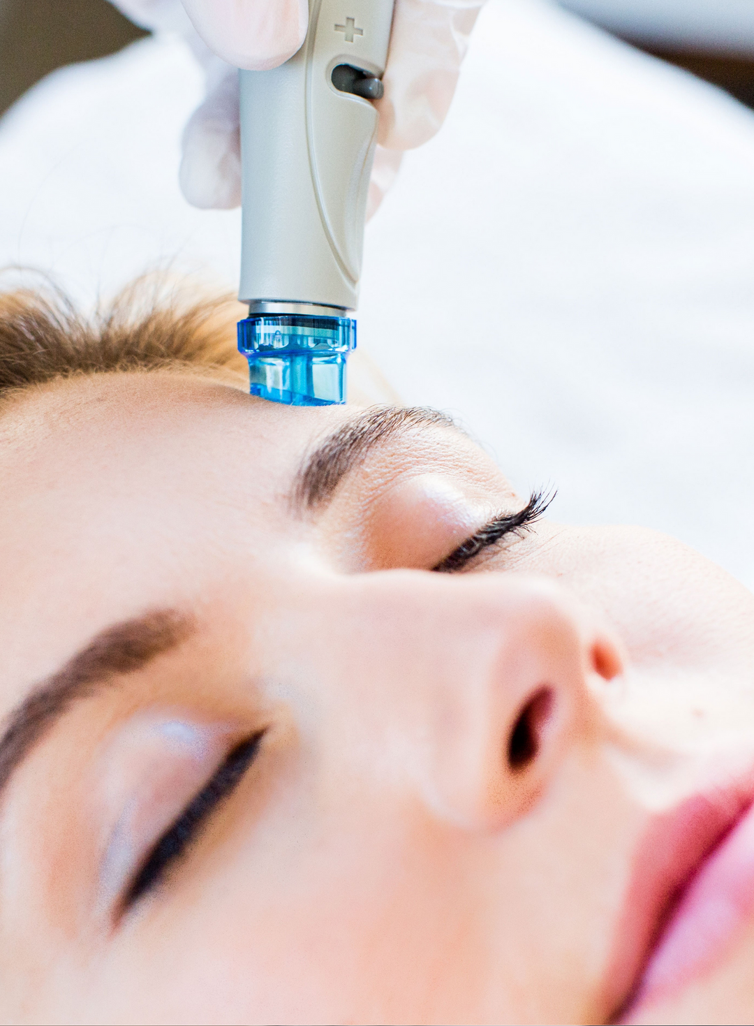 HYDRAFACIAL