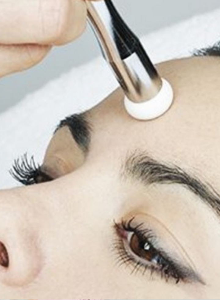 Mikrodermabrasioon Overline