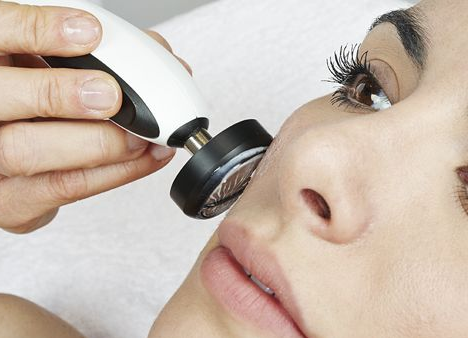 RF-Lift Overline
