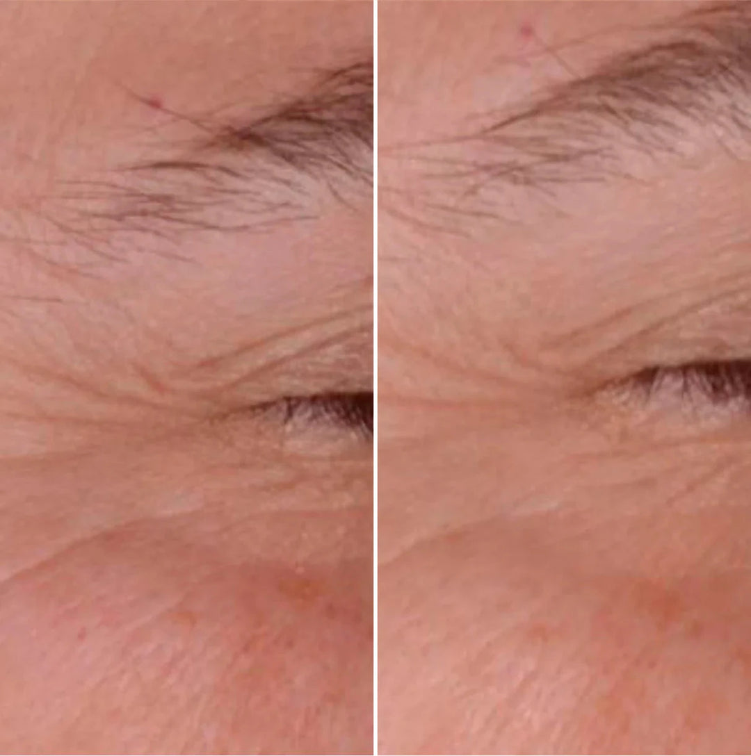Pigment-Wrinkle Corrective Care [Glyco-C]