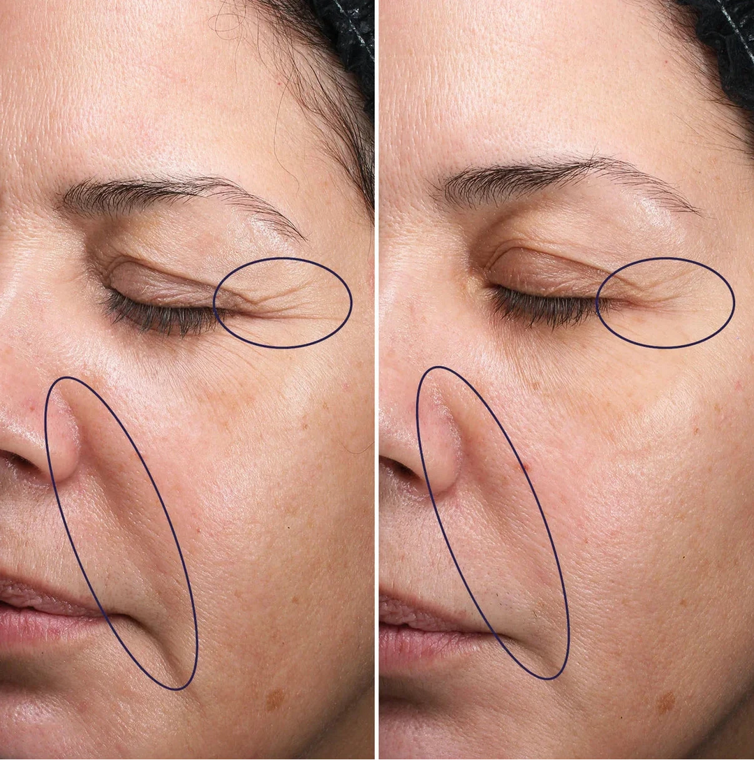 Double Action Smoothing Mask [Age Detox®]